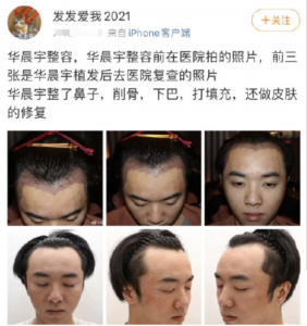 华晨宇